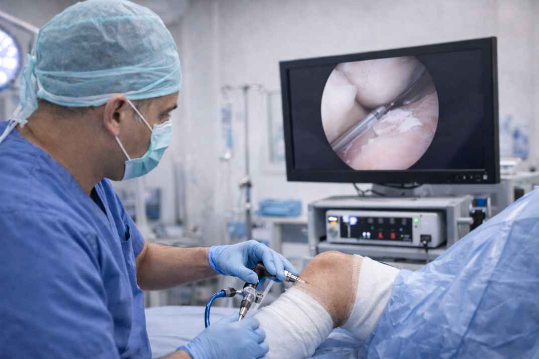 Orthopedic surgeon performing knee arthroscopy with live camera guidance in operating room