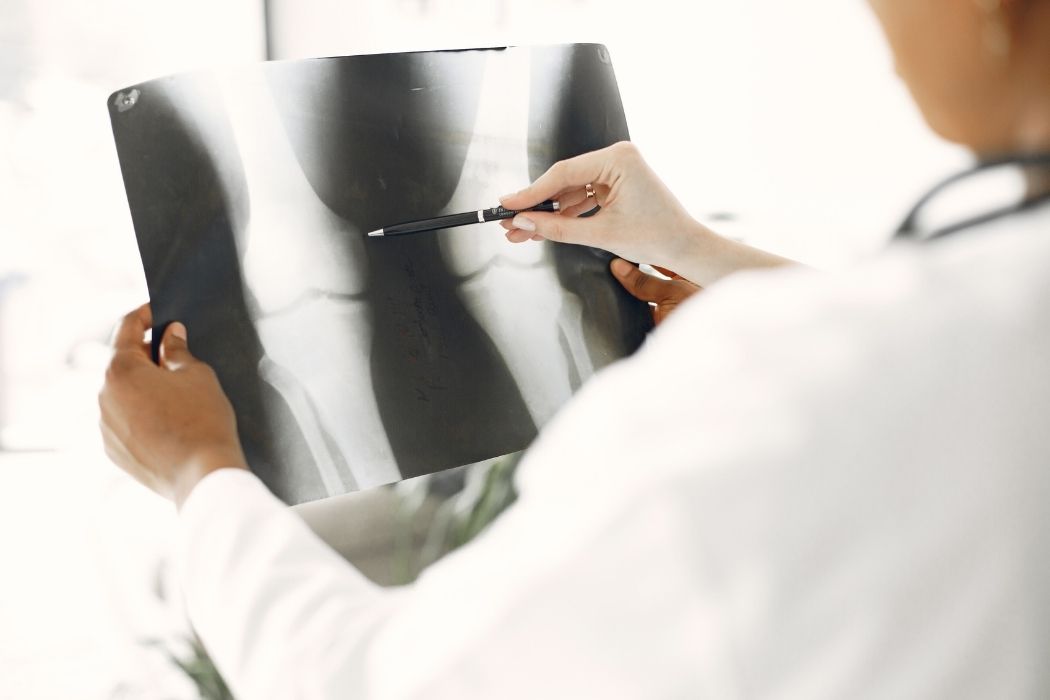 Doctor examining knee X-ray for joint or bone assessment