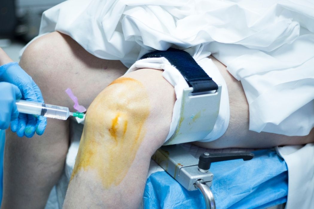 Doctor administering knee joint injection under sterile conditions