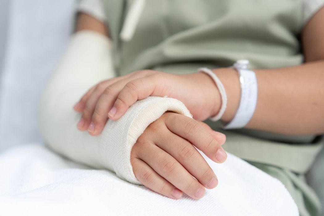 Patient resting with arm cast after fracture treatment in hospital