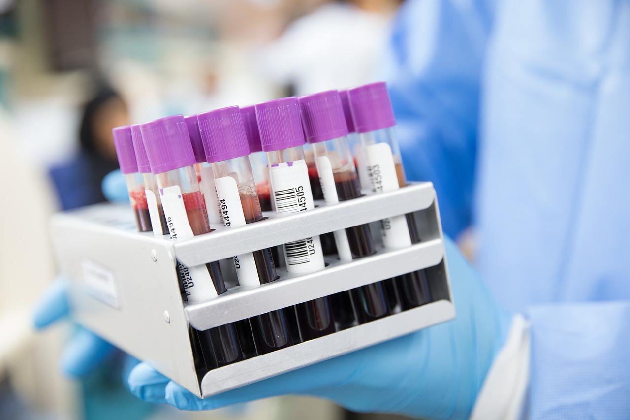 Healthcare professional holding a rack of blood sample tubes prepared for laboratory testing.