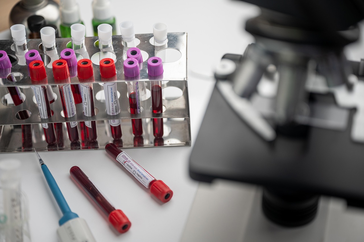Blood sample test tubes arranged in a laboratory rack beside a microscope for medical analysis.