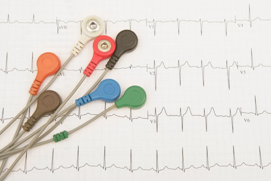 ECG with electrodes