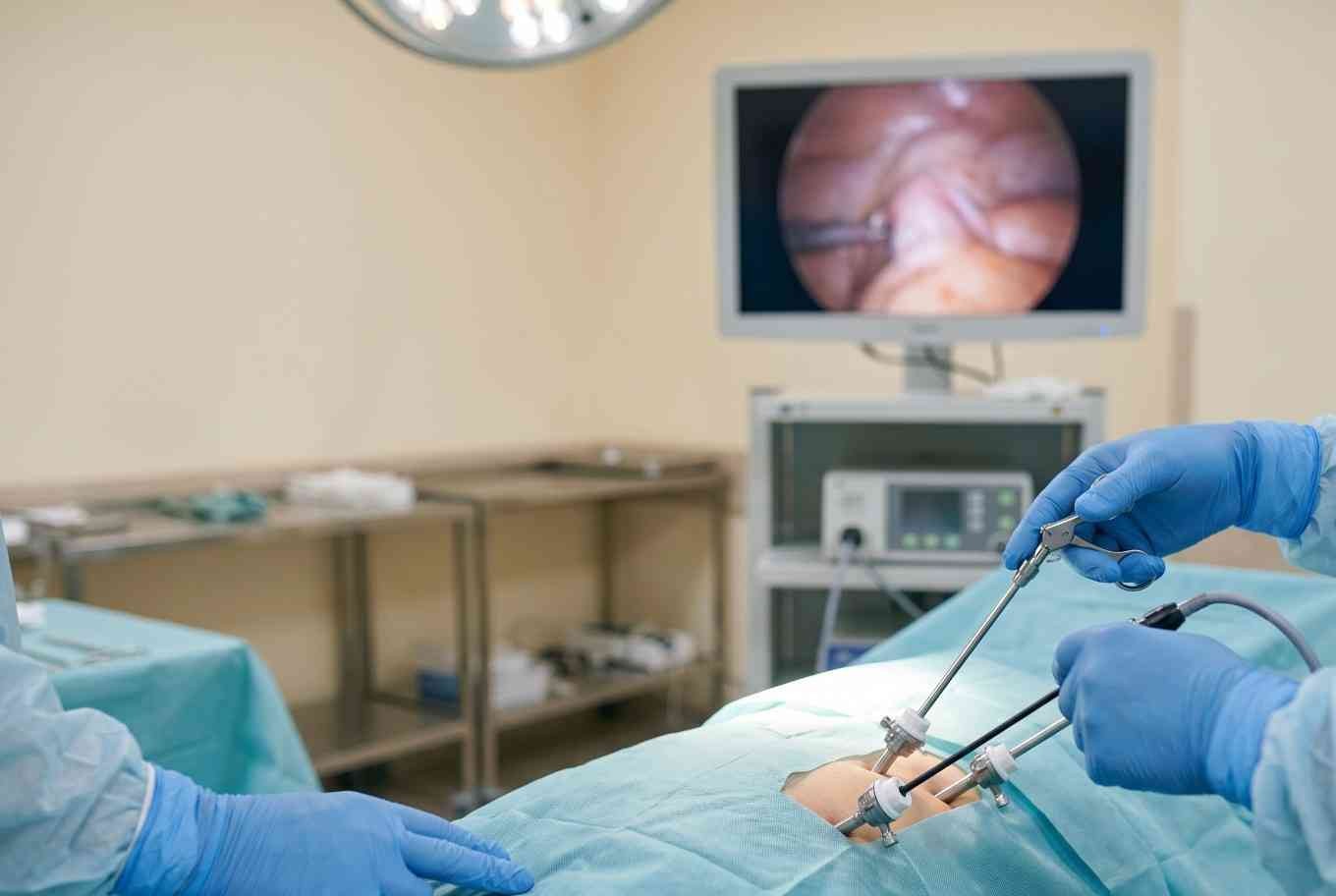 A doctor operating a patient in OT