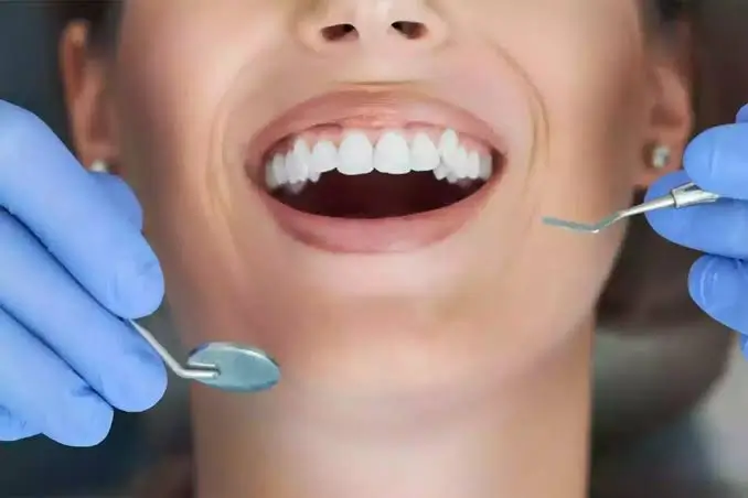 Adult patient receiving a professional dental examination with a dental mirror and scaler during a routine oral health checkup.