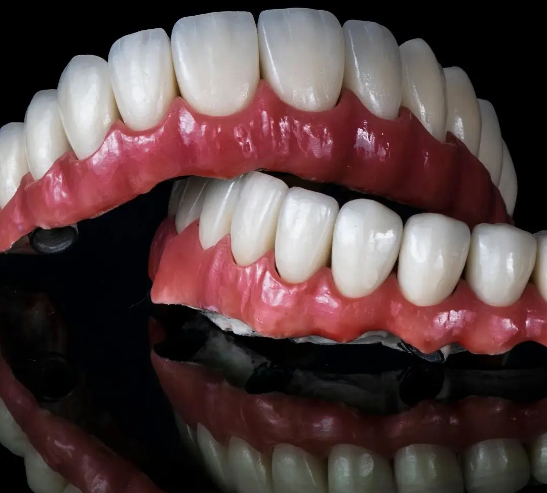 Full upper and lower complete dentures with acrylic gum base and natural-looking artificial teeth designed to restore missing teeth, chewing function, and smile aesthetics.