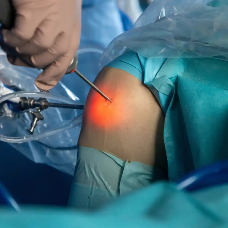 Neurosurgery care for brain spine and nerve conditions at Nishat Hospital in Lucknow