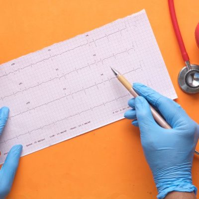 A doctor examining ECG