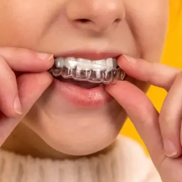 Orthodontics-TMJ